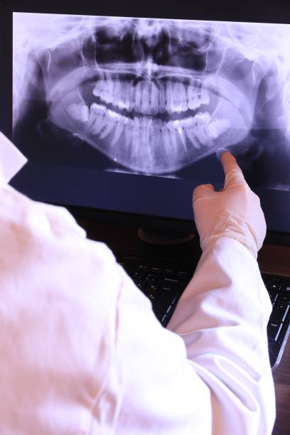 Best Emergency Dentist for Knocked-Out Tooth in Fruitridge Pocket, CA