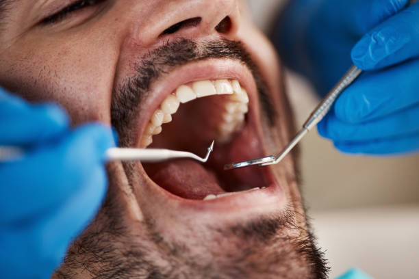 Best Emergency Dentist for Special Needs Patients in Fruitridge Pocket, CA